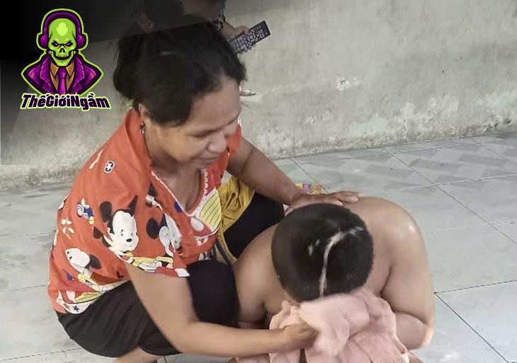 Học Sinh Lớp 3 Bị Tai Nạn Sống Đời Thực Vật: Ai Là Người Chịu Trách Nhiệm?